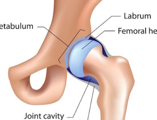 Are you a Triathlete with Hip Labrum Issues?